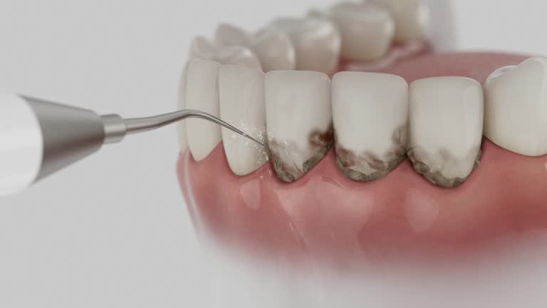 Reliable Wisdom Tooth Removal contractor in McHenry County County, IL by Dentist Open Now